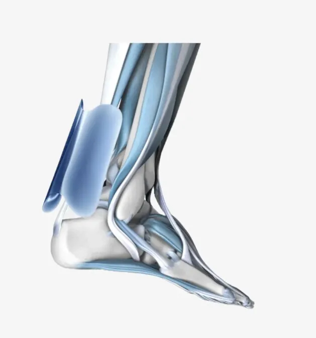 achillotrain achillespees brace van bauerfeind